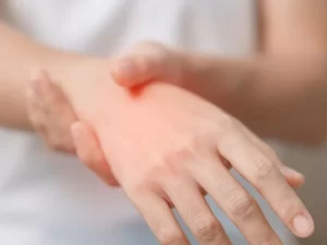 Canabigerol: uma nova abordagem para a dor crônica neuropática